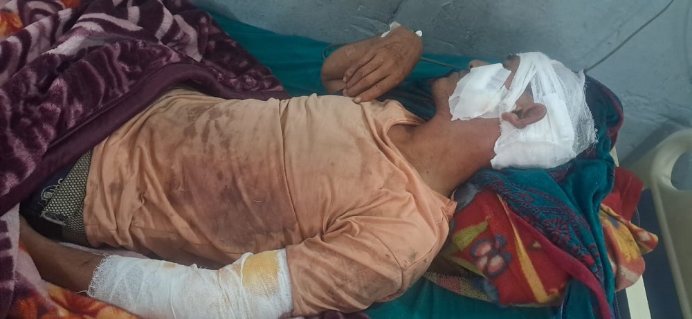 अछाममा बाघको आक्रमणबाट एकजना गम्भीर घाइते