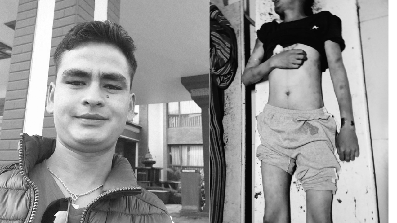 कैलालीमा कैदीबन्दीको मृत्यु, शरीरभरि निलडाम